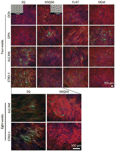 Figure 7. Expression of progenitor and osteoblast markers by MSCs cultured on SQ, NSQ50 and controls (i.e. flat and osteogenic media (OGM)) after four and eight weeks of culture and the insets show SEM images of the SQ and NSQ50 surfaces. (a) On the flat surface the cells had fibroblast-like morphology and the heterogeneous cell population, retained stromal precursor antigen-1 (STRO-1) and activated leukocyte cell adhesion molecule (ALCAM) expressions (i.e. the MSC markers) and expressed OCN and OPN markers. On the OGM control, the expression of the less specific progenitor marker, ALCAM, was retained while OCN and OPN expressions were noted. The cells had grown confluence on SQ and no expression of OCN or OPN was noted. STRO-1 and ALCAM markers were highly expressed on SQ but only low levels of STRO-1 were noted on NSQ50. (b) STRO-1 is a more stringent marker for MSC than ALCAM which is expressed by both stem cells and progenitor cells. Expression of ALCAM on NSQ50 at eight weeks suggests that there are still osteoprogenitor cells present although the actual MSC numbers have dwindled. In all images, green = phenotypic marker, red = actin (cell morphology) and blue = nucleus. Images reproduced with permission from [Citation50].