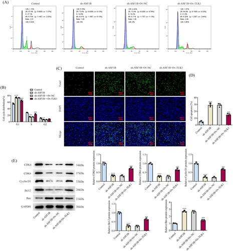 Figure 7. Upregulation of TLK1 partially reverses the effects of ASF1B interference on cell apoptosis. (A and B) Cell cycle was detected by flow cytometry. (C and D) TUNEL assay detected cell apoptosis. E and F. Western blot was used to detect the expression of cell cycle and apoptosis-related proteins. ***p < 0.001 vs Control; #p < 0.05, ###p < 0.001 vs sh-ASF1B + Ov-NC.