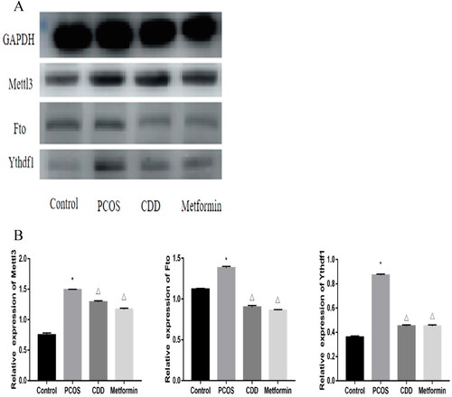 Figure 11. Effect of CDD on the m6A proteins in the ovarian tissue of PCOS rats. A: The image of western blot band. B: The expression of proteins including Mettl3, Fto, and Ythdf1. Data are shown as means ± SD (n =3), and data between multiple groups were compared by one-way ANOVA. Compared with the normal group, *p < 0.05; compared with the PCOS group, △p < 0.05.