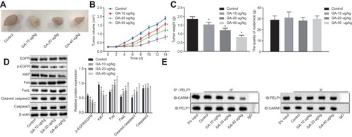 Figure 5 The growth of NSCLC xenografts was suppressed by gallic acid. (A and C) Representative images of xenograft tumors and quantitative analysis of body weight and tumor weight after treatment of 10 μg/kg, 20 μg/kg, and 40 μg/kg of gallic acid. (B) Volume data of the transplanted tumors at different time points after treatment with 10 μg/kg, 20 μg/kg, and 40 μg/kg of gallic acid. (D) Western blot analysis of phosphorylated EGFR, EGFR, Ki67, Fas, FasL and Cleaved caspase 3 proteins in transplanted tumors. (E) The binding of CARM1 to PELP1 in nude mice treated with 10 μg/kg, 20 μg/kg, and 40 μg/kg of gallic acid detected by Co-IP assay. The above results were all measurement data and expressed as mean ± standard deviation. Data comparison in panel B was performed by repeated measurement ANOVA, followed by Bonferroni’s post hoc test. Data in panel C and D were analyzed using one-way ANOVA, followed by Tukey’s multiple comparisons post hoc test. *p < 0.05 vs. the control mice (without treatment of gallic acid). Comparisons between two groups were analyzed using an unpaired t-test, comparisons among multiple groups were analyzed using one-way ANOVA, followed by a Tukey’s multiple comparisons post hoc test. Comparisons at different time points were performed by repeated-measures ANOVA, followed by Bonferroni’s post hoc test, n = 10.