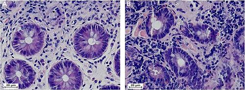 Figure 1 Histopathological changes of the two group (× 400). (A) Colonic mucosal histology of normal controls (× 400); (B) Colonic mucosal histology of IBS-D patients (× 400). The positive cells were purple and blue. Hematoxylin-eosin (HE) was used for staining in the detection. IBS-D: Diarrhea-predominant irritable bowel syndrome.