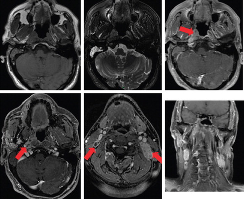 Figure 2. MRI pre-treatment.