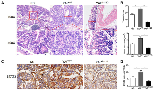 Figure 5 Nuclear YAP overexpression (YAPWT) promoted the development of CAC, cytoplasmic YAP overexpression(YAPS112D) downregulated STAT3 expression and inhibited CAC progression. All mice were sacrificed after the 3 cycles of AOM/DSS procedure ended (n=6 each), the experiments were carried out in three independent replications. (A) Histological analysis of colorectal tumors from NC, YAPWT and YAPS112D mice. (B) Statistical analysis of tumor numbers and areas in colons of NC, YAPWT and YAPS112D mice. (C) IHC staining of STAT3 in tumors from NC, YAPWT and YAPS112D mice. (D) The bar graph was presented the statistical results of STAT3 IHC staining in different groups. Scale bars =20μm. Data were presented as mean ± SEM, *P< 0.05, **P< 0.01, ***P< 0.001.