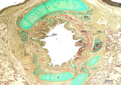 Figure 1.  Large airway of an asthmatic patient stained with Movatｴs pentachrome. With this staining, cartilage and mucous cells stain in blue, muscle in red, elastin in black/purple and connective tissue in yellow. The analyzed airway compartments were: inner wall (iw), airway smooth muscle (asm), submucosal glands area (sm) and outer wall (ow). Basement membrane = bm. Cartilage = c. Scale bar = 250 μm.