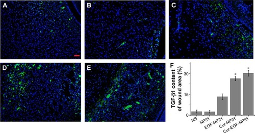 Figure 8 TGF-β1 staining of the wounds.Notes: Fluorescent microscopy of TGF-β1 staining wounds treated with NS (A), NP/H (B), EGF-NP/H (C), Cur-NP/H (D), and EGF-Cur-NP/H (E) at day 7 post-wounding. Nuclei were stained blue with DAPI, and TGF-β1 was stained green. (F) Semi-quantitative estimation of TGF-β1 expression in each group. Data were presented as mean ± SD, n=10, *P<0.05 was considered significant. Scale bar =50 μm, magnification 20×.Abbreviations: NS, normal saline; NP, nanoparticle; H, hydrogel; EGF, epidermal growth factor; Cur, curcumin; DAPI, 4′,6-diamidino-2-phenylindole; SD, standard deviation; TGF-β1, transforming growth factor beta-1.