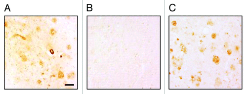 Figure 6. (A) Rabbit immune sera generated after three immunizations with AV-1955 (at dilution 1:250) bound to the 40 μm brain sections of cortical tissues from a severe AD case. (B) Binding of sera to amyloid plaques was blocked by pre-absorption of the sera with 2.5 μM Aβ42 peptide. (C) Anti-Aβ MoAb, 6E10 was used as a positive control. The original magnification is 10× and the scale bar is 100 μm.