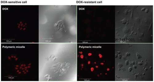 Figure 9 Fluorescence images of doxorubicin-sensitive and doxorubicin-resistant HuCCT1 cells. HuCCT1 cells were exposed to doxorubicin or polymeric micelles (equivalent concentration of doxorubicin 1 μg/mL) for 1 hour. Fluorescence images of cells were observed with confocal laser scanning microscopy.