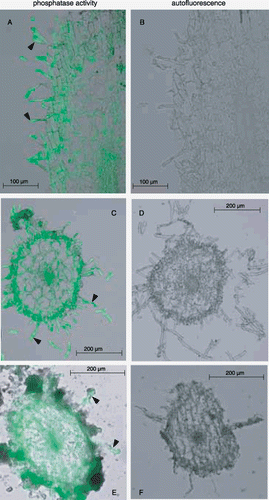Figure 4  Visualization of the histochemical activity of APase for cluster rootlets formed under –P conditions using ELF97 phosphate as a substrate. Hydroponically and soil-cultured white lupin roots were used for this experiment. The results of the activity staining and autofluorescence are shown in the left (A,C,E) and right (B,D,F) panels, respectively. (A,B) Vertical sections of a cluster rootlet in a hydroponic plant; (C,D) transverse sections of a cluster rootlet in a hydroponic plant; (E,F) transverse sections of a cluster rootlet in a soil culture plant. Triangles indicate typical root hairs.