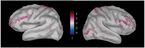 Figure 5. Brain maps highlighting the regions that show a significant emergence of the looming bias in the left and right hemisphere, averaged over the time window between 120 and 200 ms (Baumgartner et al., Citation2017). Differences are mostly localized in temporal, parietal and frontal regions