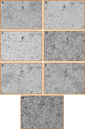 Figure 1 Inhibitory effect of ATRA on Asperillus and Candida germination.