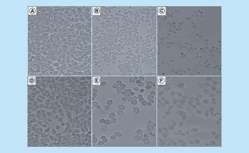 Figure 2. Light microscopy analysis of the effect of arsenic trioxide, cobalt chloride and curcumin on the morphology of MCF-7 cells.Morphological characteristics of MCF-7 cells after the treatment for 24 h with (2B) 11 μM and (2E) 32 μM arsenic trioxide, (2C) 100 μM cobalt chloride and (2F) 100 μM curcumin as compared with (2A & 2D) untreated cells.