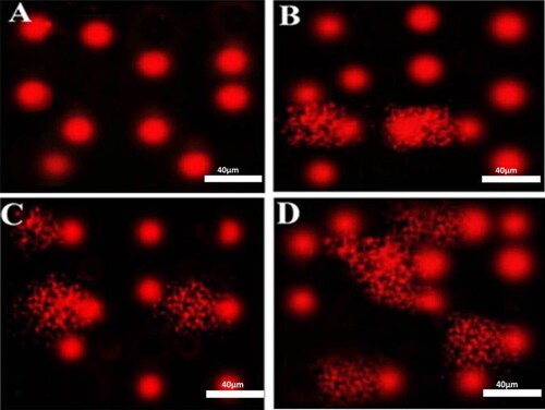 Figure 1. Photomicrographs representation of DNA damage in peripheral blood mononuclear cells using comet assay in control group (A), diabetic group without retinopathy (B), nonproliferative diabetic retinopathy group (C), proliferative diabetic retinopathy group (D). (The scale bar is 40 µm, 5 fields were assessed to provide this representative image).