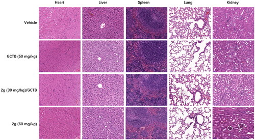 Figure 6. Representative H&E-stained tissue section (scale bar, 50 µM for all) from CDX mice treated with vehicle, GCTB or 2g alone, or combination of GCTB and 2g for 3 weeks.