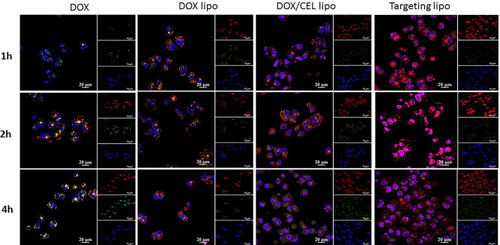 Figure 6 CLSM images of MCF/ADR human breast cancer cells after incubation at different times with DOX, DOX lipo, DOX/CEL lipo, and targeting lipo. DOX was visualized as the red fluorescence, nucleuses labeled with DAPI were shown as the blue fluorescence and green fluorescence indicates lysotracker green labeled- mitochondria. Scale bars correspond to 20 μm in all images.