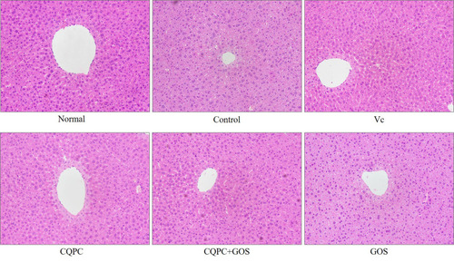 Figure 1 Effects of Lactobacillus fermentum CQPC08 and in combination with GOS on the liver morphology of exercise-induced fatigue mice. Magnification 200×. Normal and control: vehicle (0.9% normal saline); Vc: 200 mg/kg of vitamin C in vehicle; CQPC: Lactobacillus fermentum CQPC08 (1.0 × 109 CFU/mL) in vehicle; CQPC + GOS: CQPC08 (1.0 × 109 CFU/mL) and 200 mg/kg GOS in vehicle; GOS: 200 mg/kg GOS in vehicle.