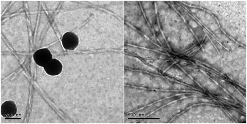 Figure 4. Transmission electron micrographs of SP OHAEC showing mixed vesicular and tubular appearances. Abbreviation: OHAEC, optimal hyaluronic acid enriched cerosomes.