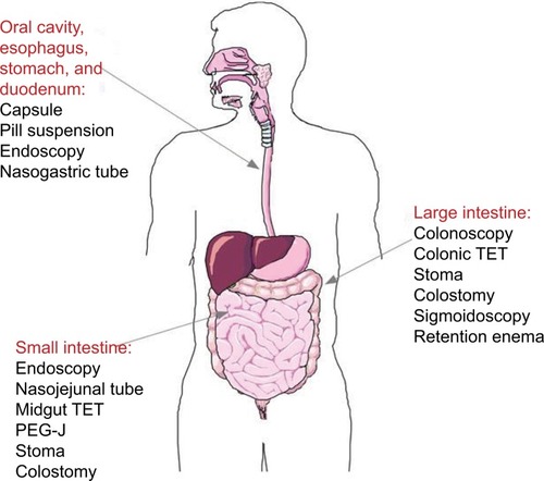 Figure 1 FMT: routes of administration.Note: Images were created with SmartDraw software (https://www.smartdraw.com).Abbreviations: FMT, fecal microbiota transplant; PeG-J, percutaneous endoscopic gastrojejunostomy; TeT, transendoscopic enteral tubing.