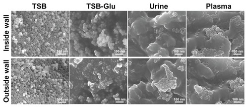 Figure 4 Catheter surface topography after incubation with biological fluids. HR SEM images of the inside and outside walls of MgF2 NP-coated catheters after 7 days exposure in TSB, TSB-Glu, urine, and plasma, as described in the experimental section.Abbreviations: Glu, glucose; HR SEM, high resolution scanning electron microscope; NP, nanoparticle; TSB, tryptic soy broth.