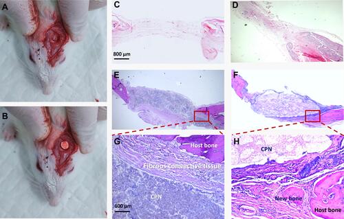 Figure 7 Histological analysis of the calcium phosphate–based nanocomposite (CPN) after implantation in a rat cranial defect model.