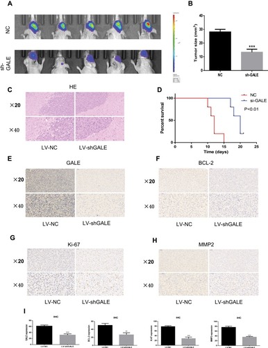 Figure 8 Silencing GALE inhibits tumorigenesis in vivo. (A) A BALB/c nude mouse model of orthotopic xenograft glioma tumor development in each group was evaluated by a bioluminescence imaging (BLI) system. (B) The tumor size (mm3) was measured. (C) Brain sections from mouse xenografts comprised of 3 × 105 U87 NC or sh-GALE cells were stained with H&E. (D) Survival rate analysis of animals implanted with cells expressing U87 NC or sh-GALE (log-rank test P<0.01; 5 animals in each group). (E–I) IHC analysis of GALE, BCL-2, Ki-67 and MMP2 in sections from the indicated xenografts. Magnification: ×200 and ×400. **P < 0.01; ***P < 0.001.