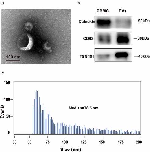 Figure 1. Human blood EVs confirmation. EVs were isolated and purified from plasma using membrane affinity spin columns. (a) Electron microscopy image of isolated vesicles. (b) Size distribution measurements of isolated vesicles. (c) Western blots of calnexin, which can be detected in PBMCs, but not in isolated vesicles, was used as a control. EV markers TSG101 and CD63 in isolated vesicles were detected in EVs, but not in PBMCs