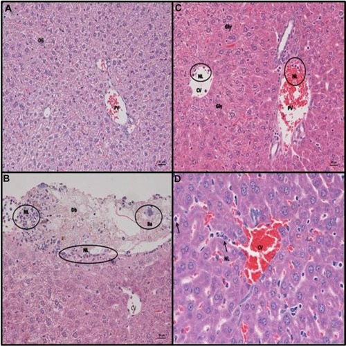 Figure 4 Representative slides from liver for animals receiving IP saline/lPs/stool suspension.Notes: Hematoxylin and eosin staining of C57BL/6 mouse liver at 6 hours post (A) intraperitoneal (IP) injection with saline. Normal histology noted, DG (B) IP inoculation of stool (5 µl/g body weight). Liver parenchyma with capsule, exhibiting focal serosal attachment of nls and cellular debris (perihepatitis). Underlying the infiltrate is a thin layer of subserosal neutrophils. Ba from the stool suspension can also be seen. (C and D) IP injection with LPS (25 mg/kg). Liver parenchyma with neutrophils in the lumen of CVs and PVs. Closer view of the liver parenchyma highlights the increased amount of neutrophils between hepatic cords. Hepatocytes do not exhibit cytoplasmic vacuolation, consistent with a diffuse loss of glycogen (scale bar =20 µm, A–C; scale bar =10 µm, D). Representative examples of neutrophils are circled “NL” in B and C and arrowed “NL” rolling along the hepatic chords in D. Bacterial colonies are circled “Ba” in B.Abbreviations: Db, bacterial debris; Gly, glycogen; LPS, lipopolysaccharide; NLs, neurtrophils; CVs, central veins; PVs, portal veins; Ba, bacterial colonies; DG, diffuse glycogen.