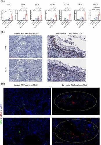 Figure 6. The combined treatment with an anti-PD-L1 mAb and ALA-PDT suppresses tumor growth by altering the TLS-mediated tumor microenvironment in UV-induced cSCC mouse model. (a) After 24 h of treatment, tumor tissues of the UV-induced cSCC mouse model were collected, and relative mRNA expression was detected by qPCR. (b) Tumor tissues (before or 24 h after ALA-PDT and anti-PD-L1) from UV-induce cSCC mouse were subjected to immunohistochemistry staining of consecutive sections. (c) Tumor tissues of mice (before or 24 h after ALA-PDT and anti-PD-L1) were subjected to immunohistochemistry staining and randomly selected from 2 sites. The yellow circles show TLSs. *p < 0.05, **p < 0.01; the scale bar is 100 μm.