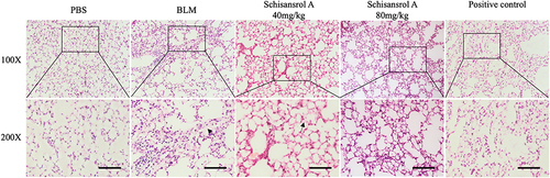 Figure 1 HE staining in lung tissues (deposition of collagen is pink, magnification, 100 and 200). In the lung tissue of the model group, collagen deposition(pink) was significantly increased, whereas the collagen deposition in the Sch A low-dose group was significantly reduced compared with the model group, and collagen deposition was hardly observed in the high-dose group. The Black arrow: collagen deposition. Scale bar: 50 mm.