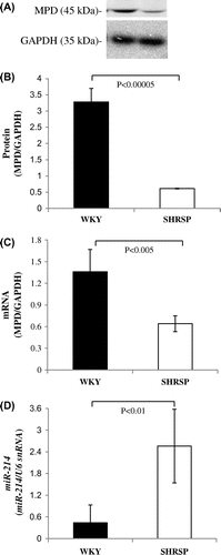Fig. 6. MPD protein and mRNA levels in WKY and SHRSP livers.Notes: A: Samples (15 μg) from the livers of WKY and SHRSP were subjected to SDS-PAGE followed by immunoblot analysis. B: Bands of MPD and GAPDH from the liver (A) were quantified using the Intelligent Quantifier. C: Real-time PCR was performed using primer pairs for MPD or GAPDH from total RNA in the livers of WKY and SHRSP. Relative protein (B) and mRNA (C) levels of MPD were quantified using GAPDH as an internal control. D: Real-time PCR was performed using primer pairs for miR-214 or U6 snRNA from total RNA containing miR in the livers of WKY and SHRSP. Relative miR-214 levels were quantified using U6 snRNA as an internal control. Values are the means ± SD of four independent experiments.