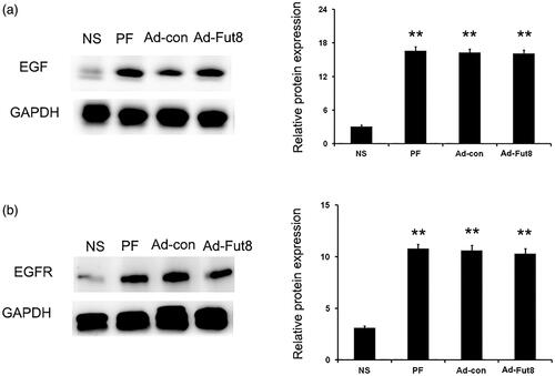 Figure 3. EGF and EGF receptor (EGFR) were upregulated by glucose PD dialysate. Representative Western blot images and analyses of EGF (a) and EGFR (b) in the normal saline (NS), peritoneal fibrosis (PF), adenovirus-control (Ad-con), and adenovirus-Fut8 (Ad-Fut8) groups. The expression of EGF and EGFR were not affected by Fut8shRNA presence. **p < 0.01 vs. NS group.