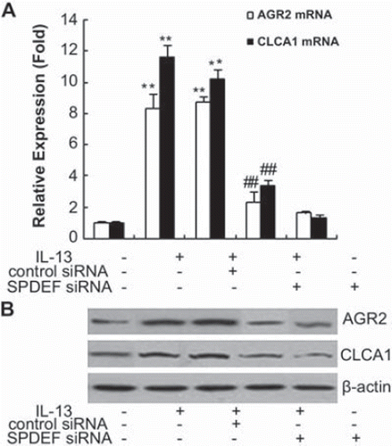 Figure 4. SPDEF regulates the gene expressions and protein production of AGR2 and CLCA1 in 16HBE cells. Real-time PCR and Western blotting were used to assess the expression level of mRNA (A) and protein (B) in each group. Western blotting analyses were performed using antibodies against AGR2 and CLCA1, as described in Materials and Methods. **p < .01, compared with the untreated group; ##p < .01, compared with IL-13-stimulated and IL-13 + SPDEF control siRNA. Data represent three independent experiments.