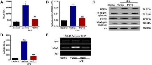 Figure 7 NF-κB inhibitor suppressed expression of CCL25. (A) The expression of CCL25. (B) Relative expression of CCL25 mRNA. (C) Western blotting to detect the protein expression of CCL25, NF-κB (plasma) and NF-κB (nucleus). (D) Luciferase assays. (E) ChIP analysis. The input was used as an internal positive control. P<0.05 indicated significant difference. **P<0.01, ***P<0.001, compared with control group; ##P<0.01, ###P<0.001, compared with vehicle group. The experiments were repeated three times.