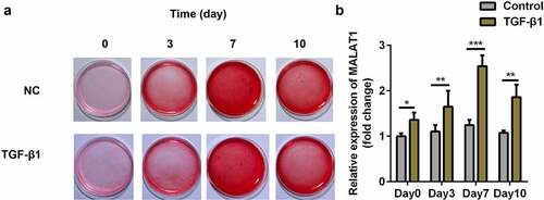 Figure 2. MALAT1 was significantly up-regulated in the TGFβ1-treated TDSCs. (a) Sirius Red staining of TDSCs treated with TGFβ1 on day 0, 3, 7, 10. (b) RT-qPCR was conducted to measure the MALAT1 expression on day 0, 3, 7, 10. *P < 0.05, **P < 0.01, ***P < 0.001.
