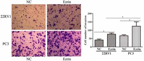 Figure 3. Transwell assays revealed marked cell invasion in Ezrin-overexpression plasmid transfected 22RV1 and PC-3 cells, compared with the negative control (NC)-tranfected cells. *P < 0.05.