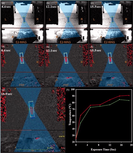 Figure 10. The protocol employed in MRgFUS sonication of PEG-MSNs. (a–c) Typical magnetic resonance phase images of a thermosensitive phantom (TSP) containing doxorubicin-loaded PEG-MSNs during MRgFUS experiments, (d–g) the changes in temperature patterns during heating process, where higher temperatures are illustrated in red, (h) a typical temperature pattern showing the minimum and maximum rates of temperature change in the focal region during sonication.