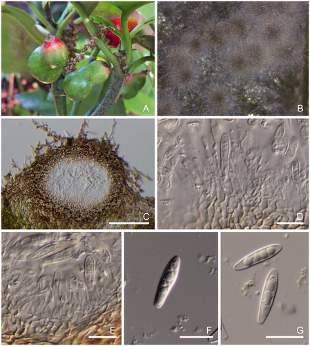 Figure 3. Morphological features of Botryoshaeria sp. (A and B: MUCC 2899). (A) fruit galls by Asphondylia aucabae on Aucuba japonica. (B) Conidiomata formation on the BMA after 7 d. (C) Vertical section of pycnidium in the leaf tissue. (D–E) Conidia and conidiophores. (F–G) Conidia. Scale bars, 200 μm (C) and 25 μm (D–G).