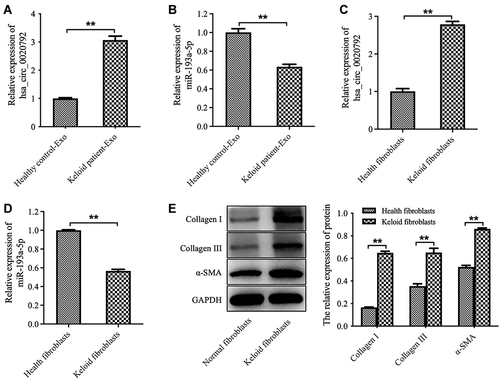 Figure 2 The level of hsa_circ_0020792 is increased and the level of miR-193a-5p is reduced in exosomes derived from patients with keloid. (A and B) The hsa_circ_0020792 and miR-193a-5p level in healthy control-Exo and keloid patient-Exo were detected using RT-qPCR. (C and D) The hsa_circ_0020792 and miR-193a-5p level in normal skin fibroblasts (NFs) and keloid fibroblasts were detected using RT-qPCR. (E) The expressions of Collagen I, Collagen III and α-SMA in NFs and keloid fibroblasts were detected using Western blot assay. **P < 0.01, n = 3.