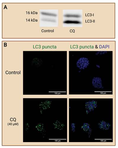 Figure 7. Evaluating autophagy in embryo-derived stem cell lines. Embryo-derived cell lines like embryonic stem (ES) cells and trophoblast stem (TS) cells are great models for evaluating autophagy in preimplantation embryos. ES cells and TS cells are derived from the ICM and trophoblast, respectively, from a developing blastocyst. These cell lines retain the typical expression of their original cell source and can thus provide potential avenues for focused investigation of embryonic cell type-specific effects. (A) Example of Western blot which shows changes of autophagy in wild-type mouse ES cells (R1 line; courtesy of Andras Nagy, Toronto), as reflected by the autophagic marker LC3-II (14 kDa), in response to chloroquine (CQ) treatment. No CQ treatment was included in the control condition. (B) Example images of IF staining of mouse ES cells to detect changes in LC3 puncta after CQ treatment. Note that treatment with CQ resulted in the accumulation of LC3 puncta (green), which reveals the buildup of autophagosomes in the ES cells after halting autophagosome degradation. No CQ treatment was included in the control condition. Scale bars = 100 µm. Created with BioRender.com. (Data and image courtesy of Hailey L. M. Hunter).