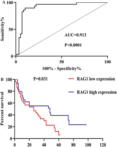 Figure 5. A: ROC analysis using RAG1 for separating MDS cases from normal controls. B: Kaplan-Meier survival curves for MDS patients were divided into two groups based on the median value of the RAG1 expression level.