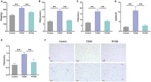Figure 1 RYGB ameliorates insulin resistance and lessens fat accumulation in rats with T2DM. (A) Body weights of rats in each group; (B) The FBG of rats was detected by blood glucose meter; (C) The FSI of rats was tested by kits; (D) HOMA-IR of rats; (E) The changes of plasma TG level of rats were measured by TG kit; (F) The morphological changes of WATs were observed by H&E staining, red arrows represent adipocyte. **P < 0.01.