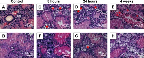 Figure 3 Histopathological changes in SMGs after irradiation (H&E staining).