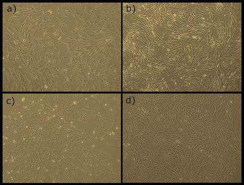 Figure 5. Different types of MSCs in culture, (a) Human Dental Pulp MSCs (P2); (b) Equine Synovial Membrane MSCs (P4); (c) Equine Umbilical Cord MSCs (P1); (d) Rat Olfactory Mucosa MSCs (P4).