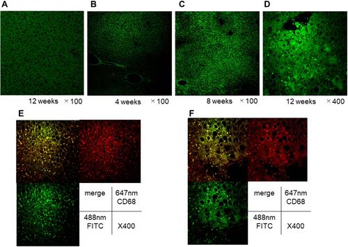 Figure 5 Liver pathology after the EGFP cell transplantation, and population of EGFP-positive cells and double immunofluorescence staining for CD68 and F4/80 in the liver of animals without splenectomy. Representative photomicrographs are shown. (A), liver tissues in normal animals fed chow diet for 12 weeks without the EGFP cell transplantation. Mice without splenectomy were sacrificed at 4 weeks (B), 8 weeks (C), and 12 weeks (D) after EGFP cell transplantation. (E), CD68 staining and F4/80 staining in the liver 16 weeks after the cell transplantation in animals without the splenectomy; and (F), CD68 staining and F4/80 staining in the liver 16 weeks after the cell transplantation in animals without the splenectomy.