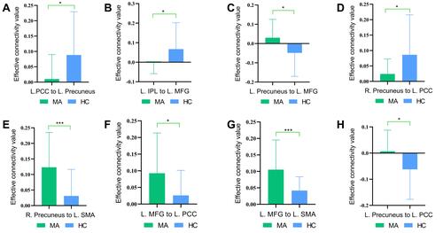 Figure 2 A significant difference in effective connectivity between the MA group and the HC group. (A) Decreased EC from the left PCC to the left precuneus. (B) Decreased EC from the left IPL to the left MFG. (C) Increased EC from the left precuneus to the left MFG. (D) Decreased EC from the right precuneus to the left PCC. (E) Increased EC from the right precuneus to the left SMA. (F) Increased EC from the left MFG to the left PCC. (G) Increased EC from the left MFG to the left SMA. (H) Increased EC from the left precuneus to the left PCC.