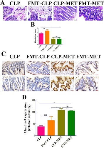 Figure 4. The effect of metformin on inflammation and intestinal barrier of the colon in the FMT experiment. (A,B) H&E staining indicated that inflammatory infiltration, oedema, and haemorrhage of colon tissues significantly increased in CLP and FMT-CLP groups compared with CLP-MET and FMT-MET groups (bar = 50 μm). (C,D) The IHS expression results of claudin-3 protein expression (bar = 50/100 μm). *P < 0.05, **P < 0.01, ***P < 0.001 (n = 3/group).