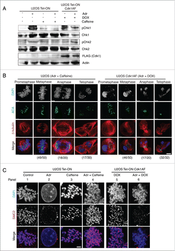 Figure 4. DNA damage response in U2OS Tet-ON Cdk1AF cells. (A) U2OS Tet-ON and U2OS Tet-ON Cdk1AF cells were treated in an identical manner to HeLa Tet-ON and HeLa Tet-ON Cdk1AF cells as described in Figure 1. Cells were collected at T=24 h. The state of pChk1, Chk1, pChk2 and Chk2 was monitored by Western blotting. (B) At T=16 h, U2OS Tet-ON Cdk1AF cells experienced an aberrant mitosis similar to that observed in HeLa Tet-ON Cdk1AF cells, whereas damaged U2OS Tet-ON cells treated with caffeine underwent normal mitosis (left panel). Cell were stained for mitotic spindle (β-tubulin, red), kinetochores (ACA, green) and DNA with (DAPI, blue). The numbers (aberrant cells/total cells) indicate the frequency of occurrence of aberrant mitotic phenotypes in one experiment. Representative images are shown. Scale bar represents 5 μm. (C) Synchronised U2OS Tet-ON, U2OS Tet-ON Cdk1AF cells were treated as described in Figure 1B. As controls, damaged U2OS Tet-ON Cdk1AF cells were also treated with Caffeine. These cells, trapped in mitosis using nocodazole, were harvested, hypotonically-swollen, fixed and stained for the condensin subunit SMC2 (red), with chromosomes counterstained with DAPI. As in the case of HeLa Tet-ON Cdk1AF cells, damaged U2OS Tet-ON Cdk1AF cells lose axial SMC2 localization which is retained in DNA-damaged U2OS Tet-ON cells treated with caffeine. Representative immunofluorescence staining images of anti- SMC2 (red) and counterstaining with DAPI are shown. Scale bar represents 5 μm.