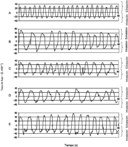 Figura 3. Patrones de respiración especificos del ejercicio registrados por el Sistema de Registro y Simulación de Respiración de un sujeto seleccionado que exhibió un QFIM más cercano a los valores promedio calculados para el panel de 25 sujetos: respiración normal (A), respiración profunda (B), cabeza de lado a lado (C), cabeza de arriba a abajo (D) y flexión hacia adelante (E).