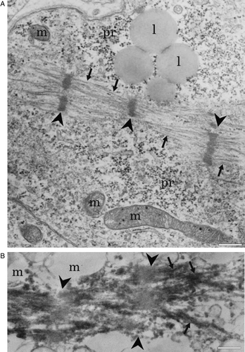 Supplementary Figure 4. A: Electron micrograph showing longitudinally organized myofibrils (arrows). Arrowheads point to developing Z lines (m = mitochondria; pr = polyribosomes; l = lipid droplets). B: Immunoelectron micrograph showing troponin I immunoreactivity in myofibrils (arrows). Arrowheads point to non-labeled area probably representing H band. Scale-bar 500 nm.