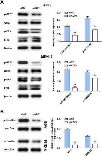 Figure 4. Interference of AQP-1 inhibited GRB7-mediated RAS/ERK activation. (A) The effect of AQP-1 on protein expression of GRB7, p-GRB7, ERK and p-ERK in AGS and MKN45 cells detected by western blot. ** represents siAQP1 vs. siNC, P < .01. (B) The effect of AQP-1 on protein expression of active and total RAS in AGS and MKN45 cells detected by western blot. ** represents siAQP1 vs. siNC, P < .01.