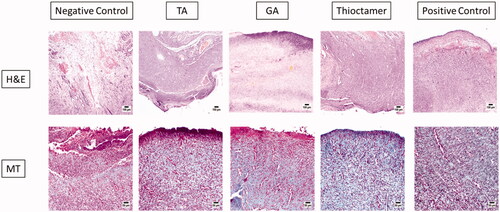 Figure 6. Histopathological effects of thioctamer loaded gel on wound healing on day 10. MT: Masson’s trichrome (scale bar = 50 µm); H&E: hematoxylin and eosin (scale bar = 100 µm).